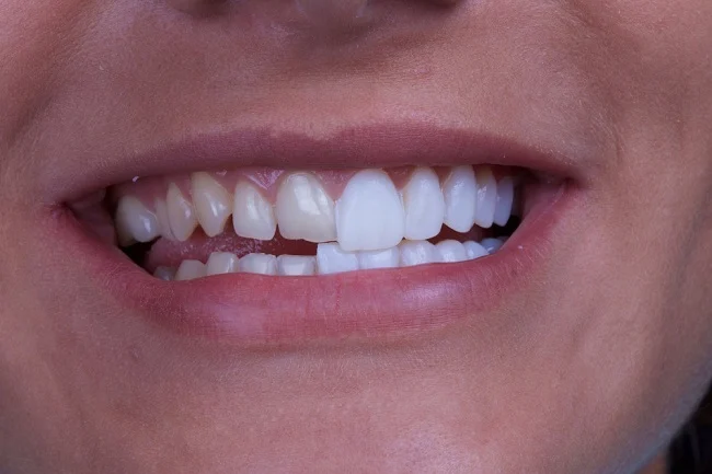 دندانپزشکی دندانپزشکی سعادت آباد