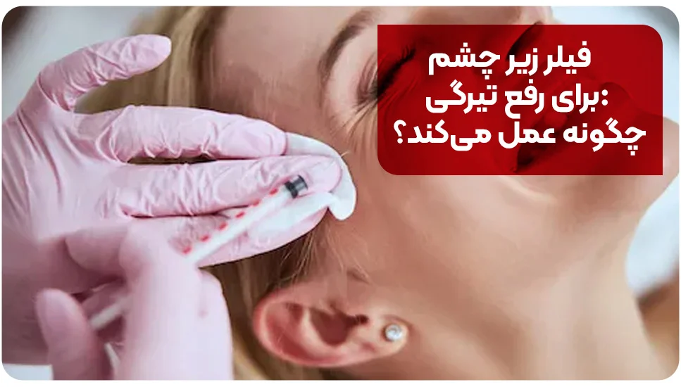 فیلر زیر چشم برای رفع تیرگی: چگونه عمل می&zwnj;کند؟