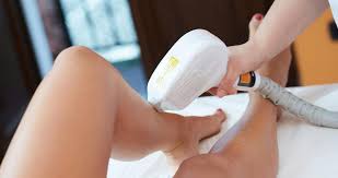 بلفاروپلاستی