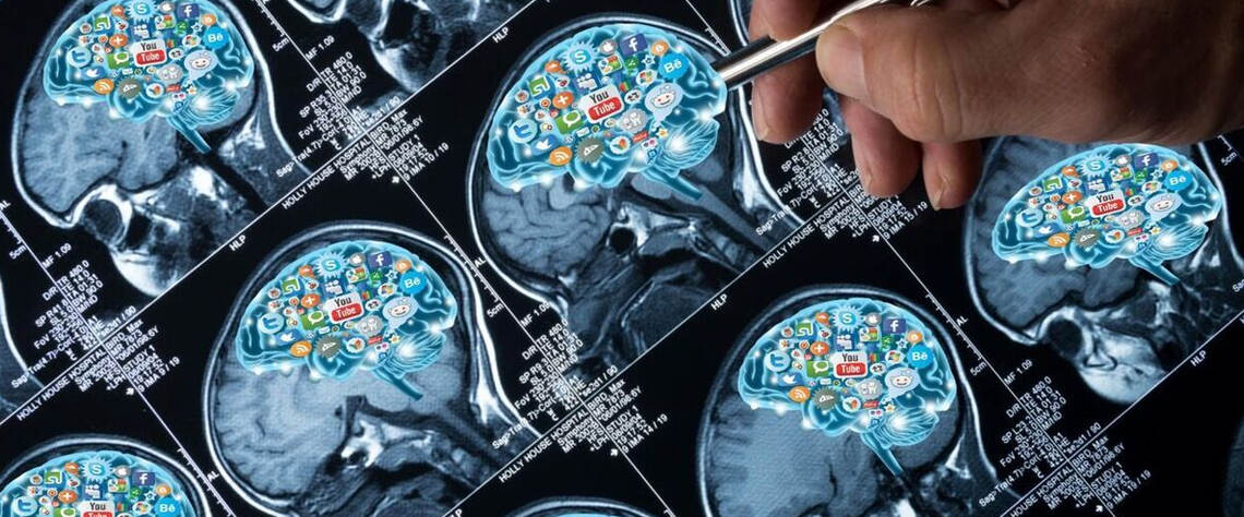 آزمایش | آلزایمر | بیماری علائمی که نشان میدهد باید چکاپ مغز انجام دهید