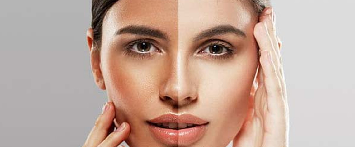 پوست | تغذیه | خرید آنلاین مزایای استفاده از سرم ویتامین C سیلکر