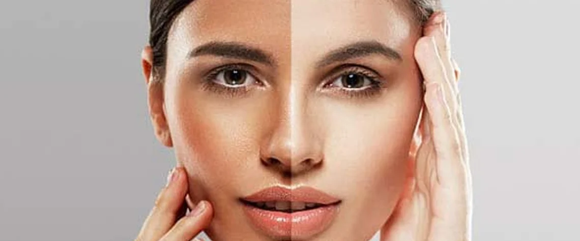 پوست | تغذیه | خرید آنلاین مزایای استفاده از سرم ویتامین C سیلکر