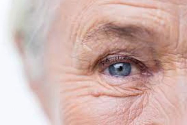 شایع‌ترین بیماری چشم در سالمندی