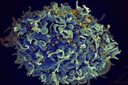 هفتمین نفر در جهان از ایدز رهایی یافت
